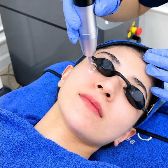 ORLYmiin Acne & Scar Treatment