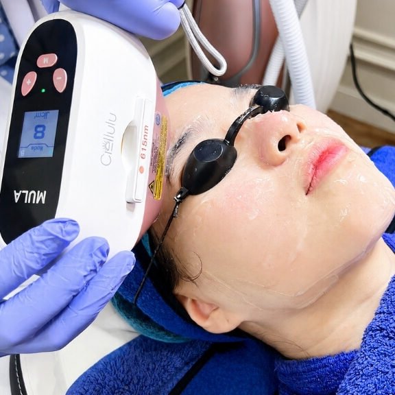 ORLYmiin Brightening & Skin Repair Laser