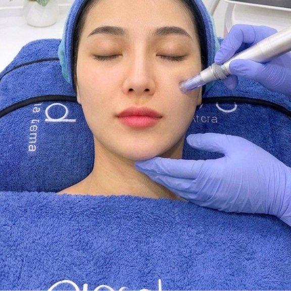 ORLYmiin Skin Booster & Rejuvenation
