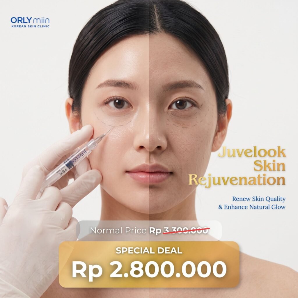 Promo Juvelook ORLYmiin