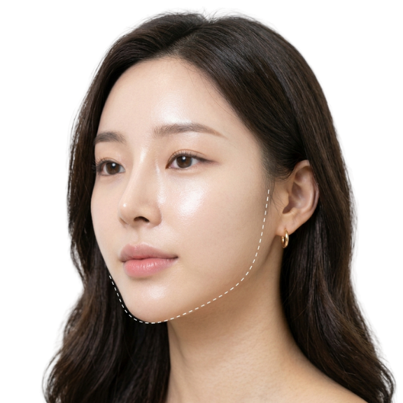 Korean V-Line Lifting ORLYmiin Korean V-Line Lifting ORLYmiin